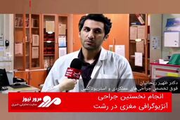 انجام نخستین جراحی آنژیوگرافی مغزی در رشت