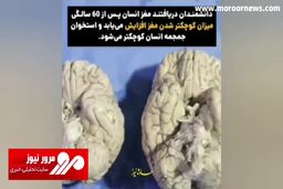 تفاوت مغز یک فرد جوان بالغ با مغز یک مرد مسن و پیر + فیلم