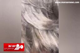 لحظه خروج ترسناک عنکبوت سمی از داخل گوش یک مرد + فیلم