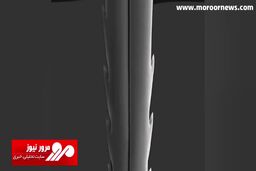 نمای نزدیک از نحوه عملکرد نیش زنبور عسل + فیلم